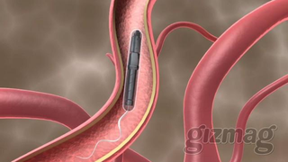 Proteus Motor Swims Through Bloodstream, Looks Pretty Much Like a Sperm